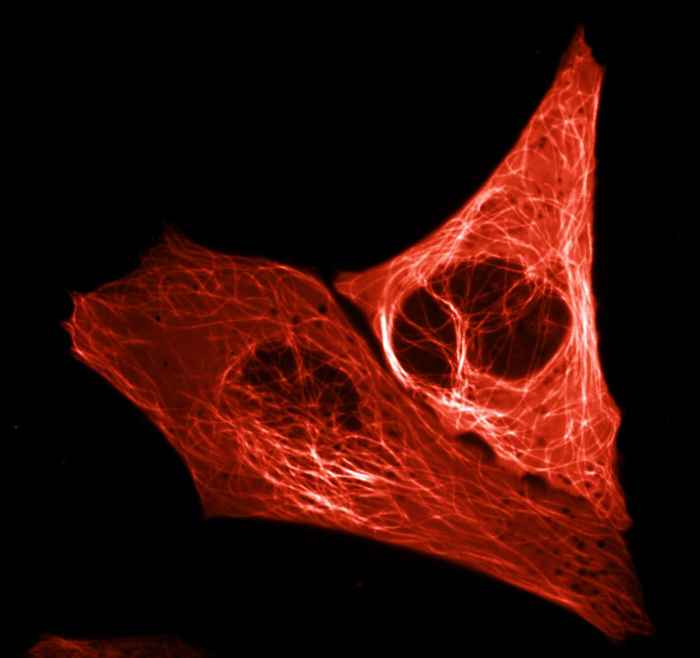 Microtubule cytoskelet